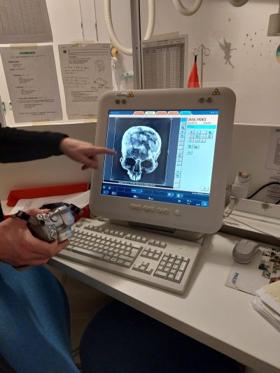 Conférence : Dans l’intimité du prince de Lavau (Aube) : étude d’un homme de pouvoir et traitement post-mortem d’un défunt hors-normes